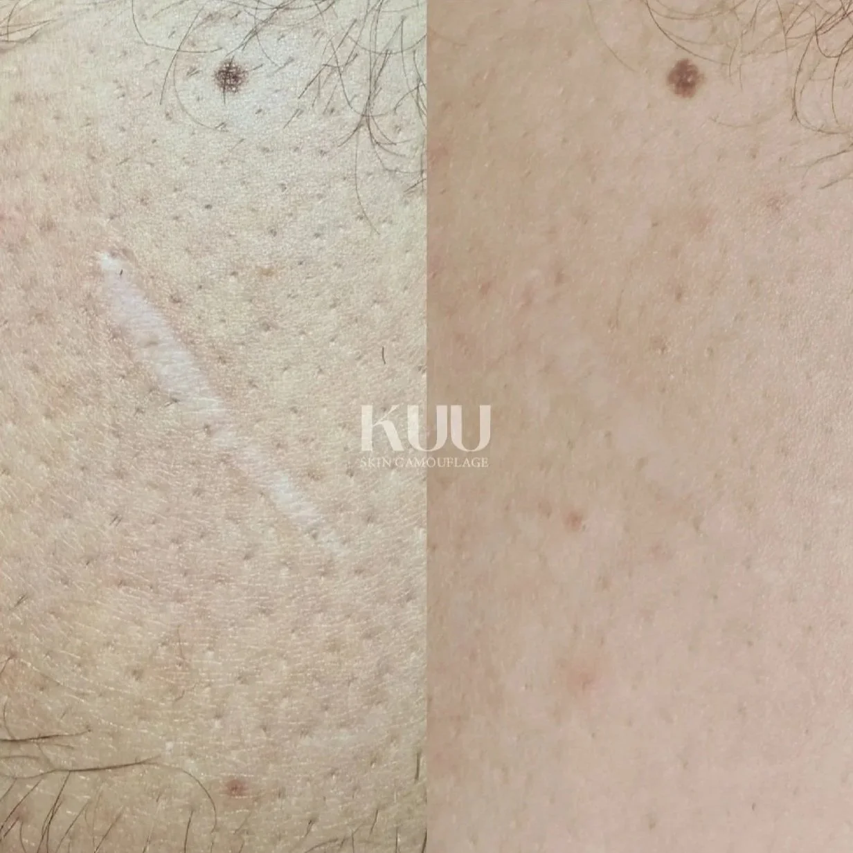 Medical Tattooing Portfolio