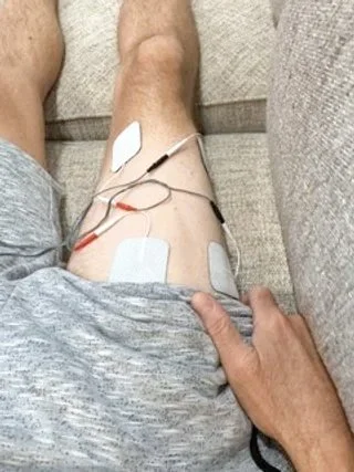 Applying and treating with E-STIM for nerve pain after the accident. 
