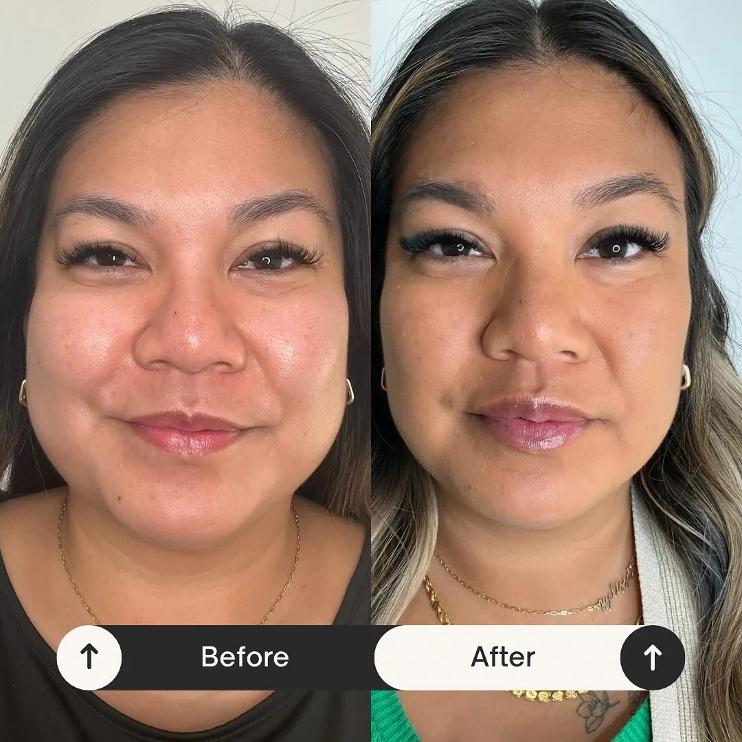 Comparison of a woman before and after cosmetic changes, showing clearer skin, different hairstyle, and makeup enhancements in the after photo.
