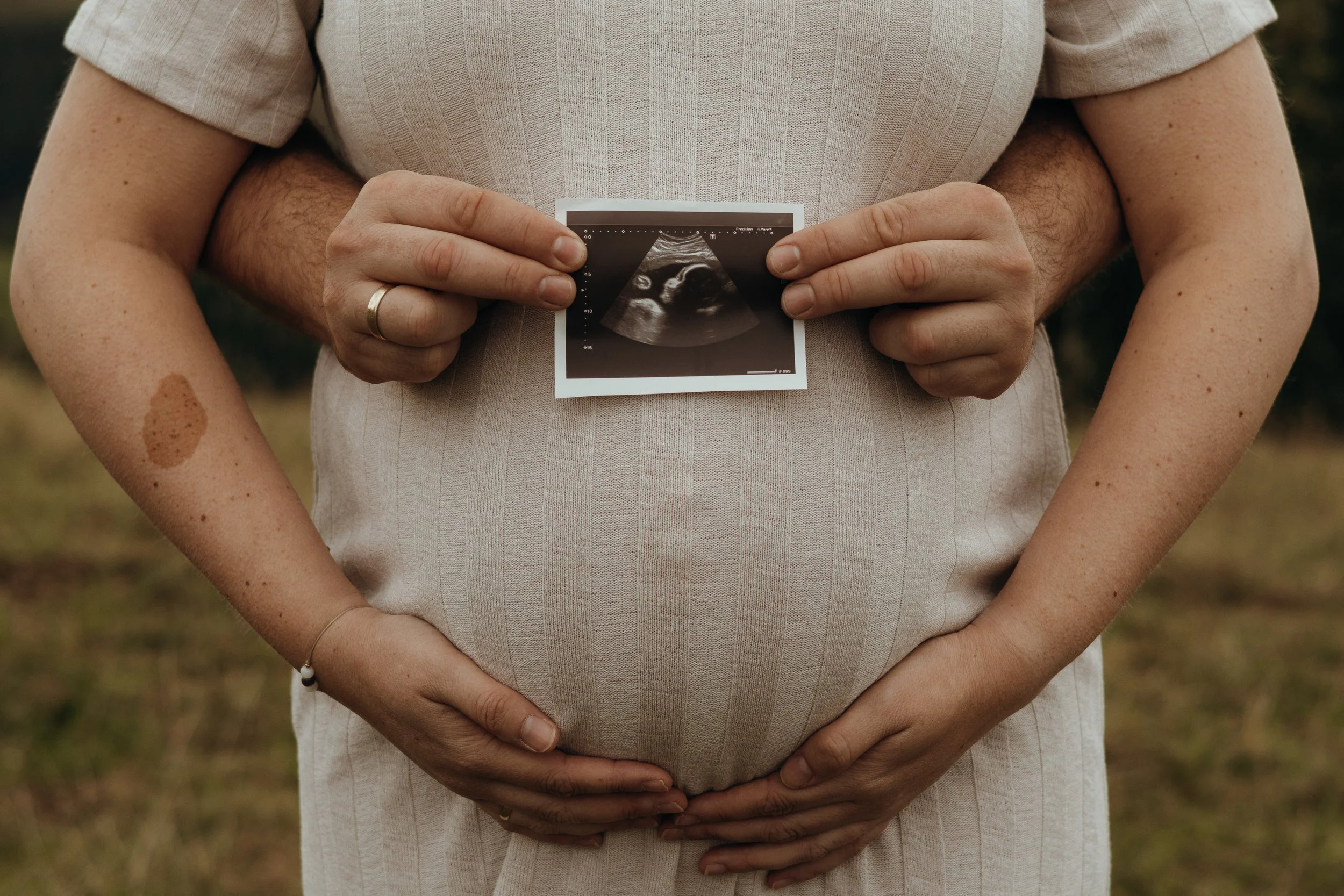 Paar hält Ultraschallbild eines Babys vor dem Bauch der schwangeren Frau, draußen im Freien.