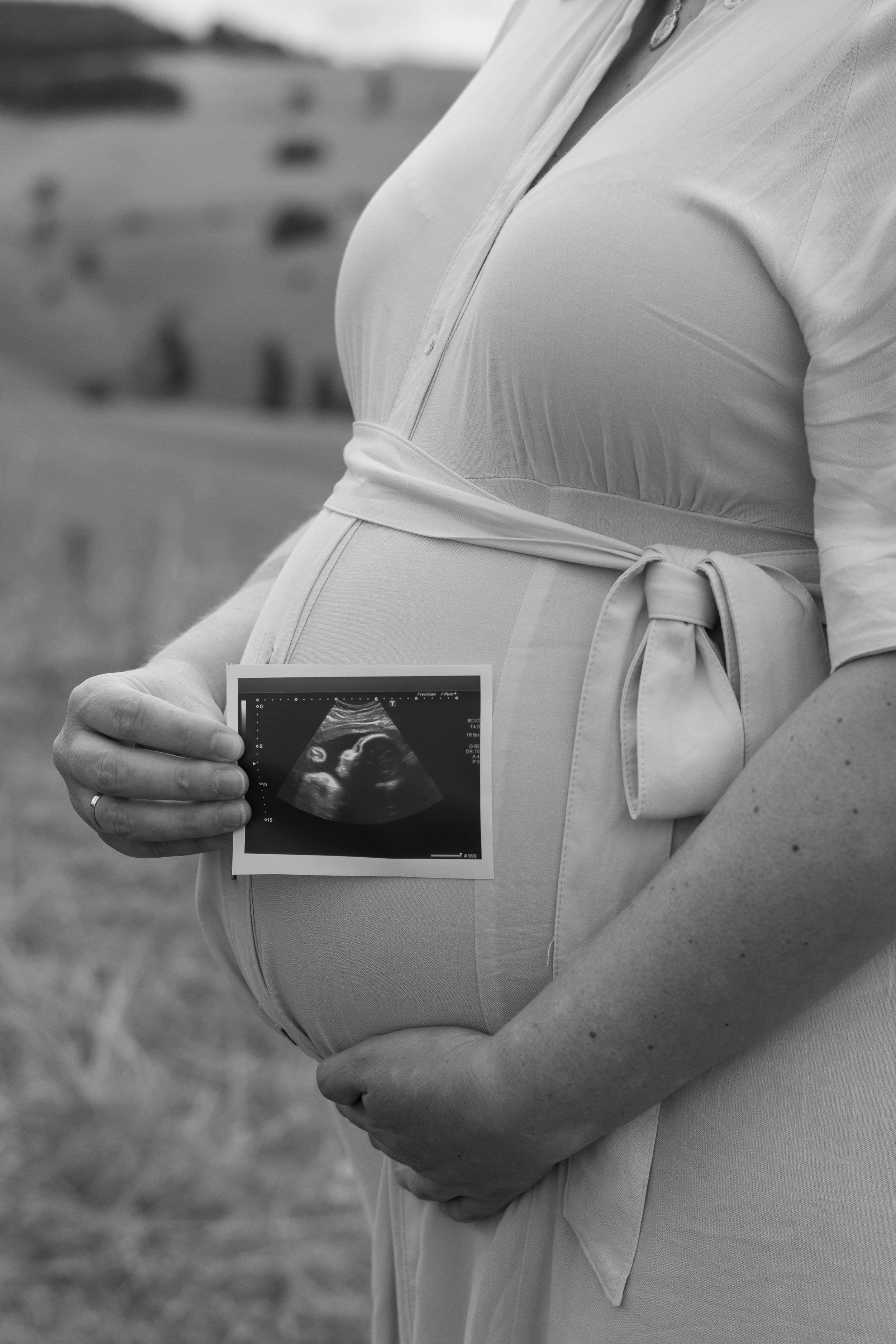 Schwangere Frau hält Ultraschallbild ihres ungeborenen Kindes vor dem Bauch. Schwarz-Weiß-Foto im Freien.