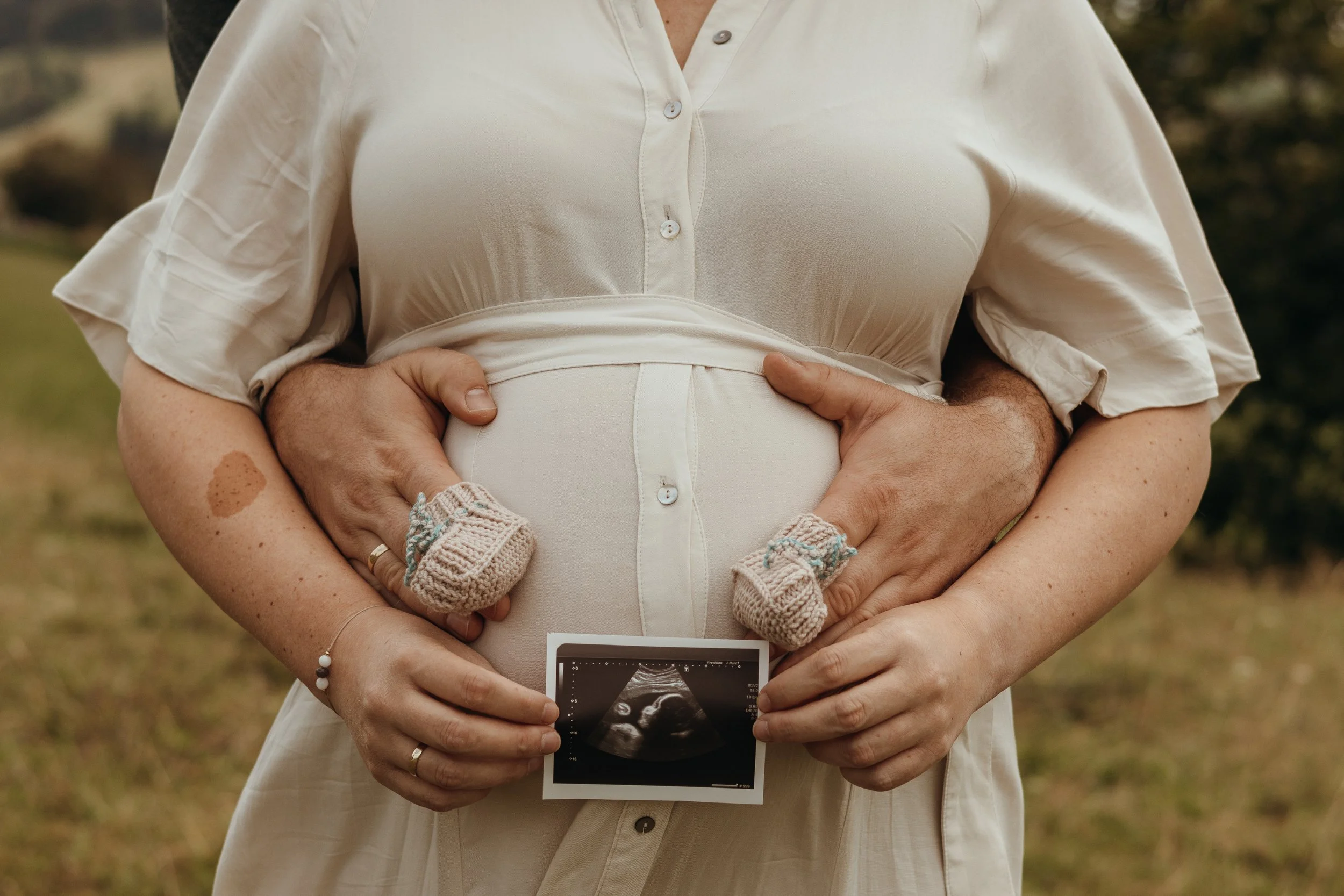 Schwangere Person im weißen Kleid, gehalten von einem Partner, der ebenfalls Hände auf den Bauch legt, Halten eines Ultraschallbildes des Babys, im Hintergrund Natur, mit zwei kleinen gestrickten Babysocken und einem Hautfleck auf dem Arm.