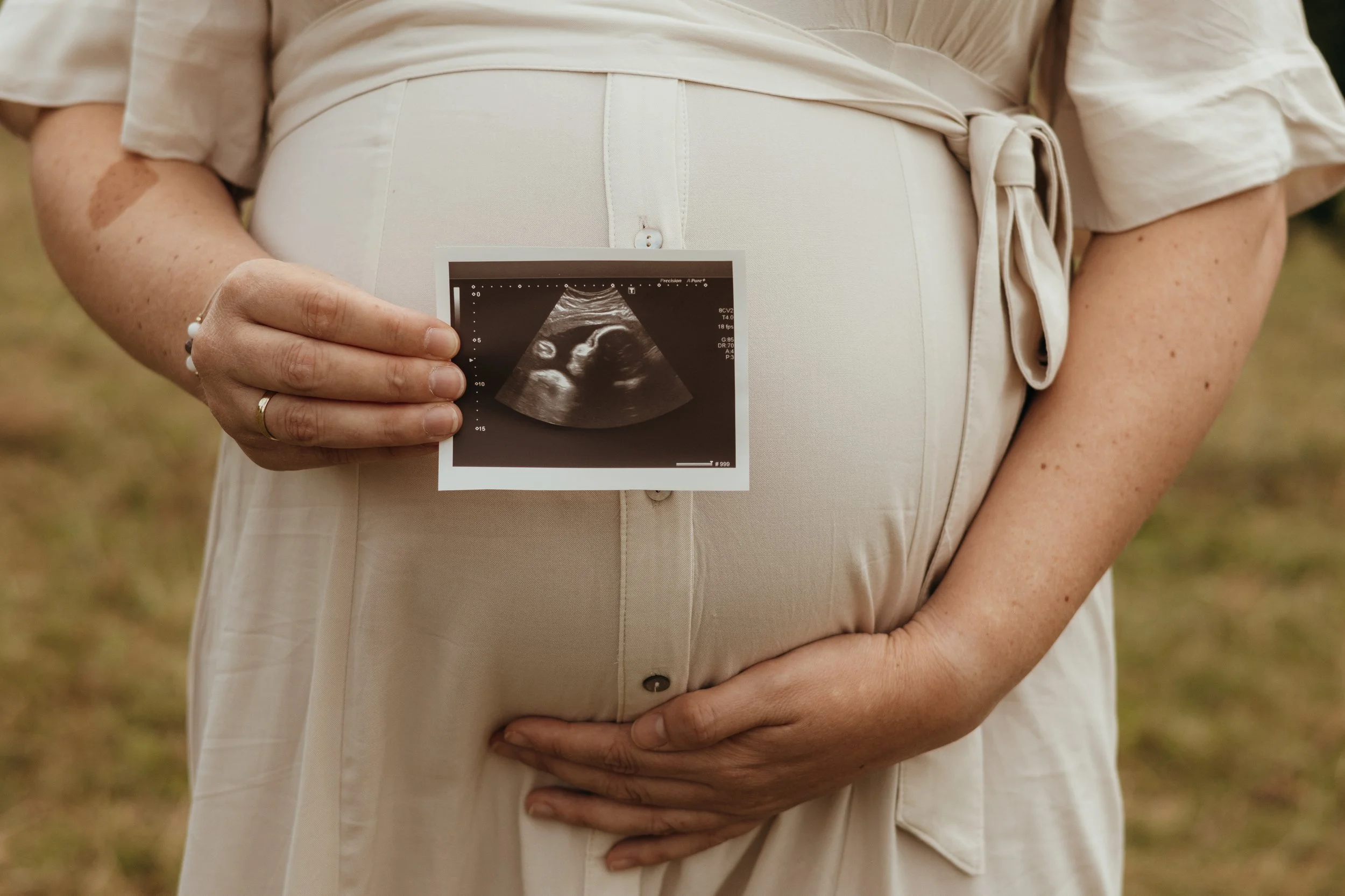Schwangere Person hält Ultraschallbild vor ihren Bauch in einer natürlichen Umgebung.