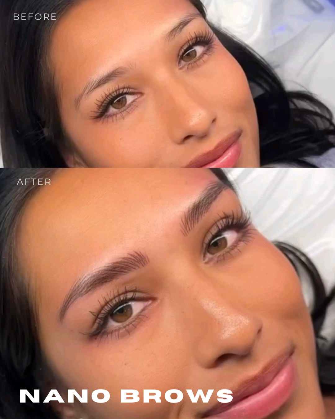 Close-up of a woman before and after receiving nano brow treatment, showing enhanced eyebrow appearance.
