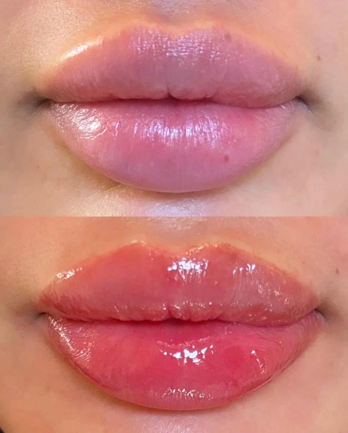 Lip blush healing results showing natural tint and symmetry.