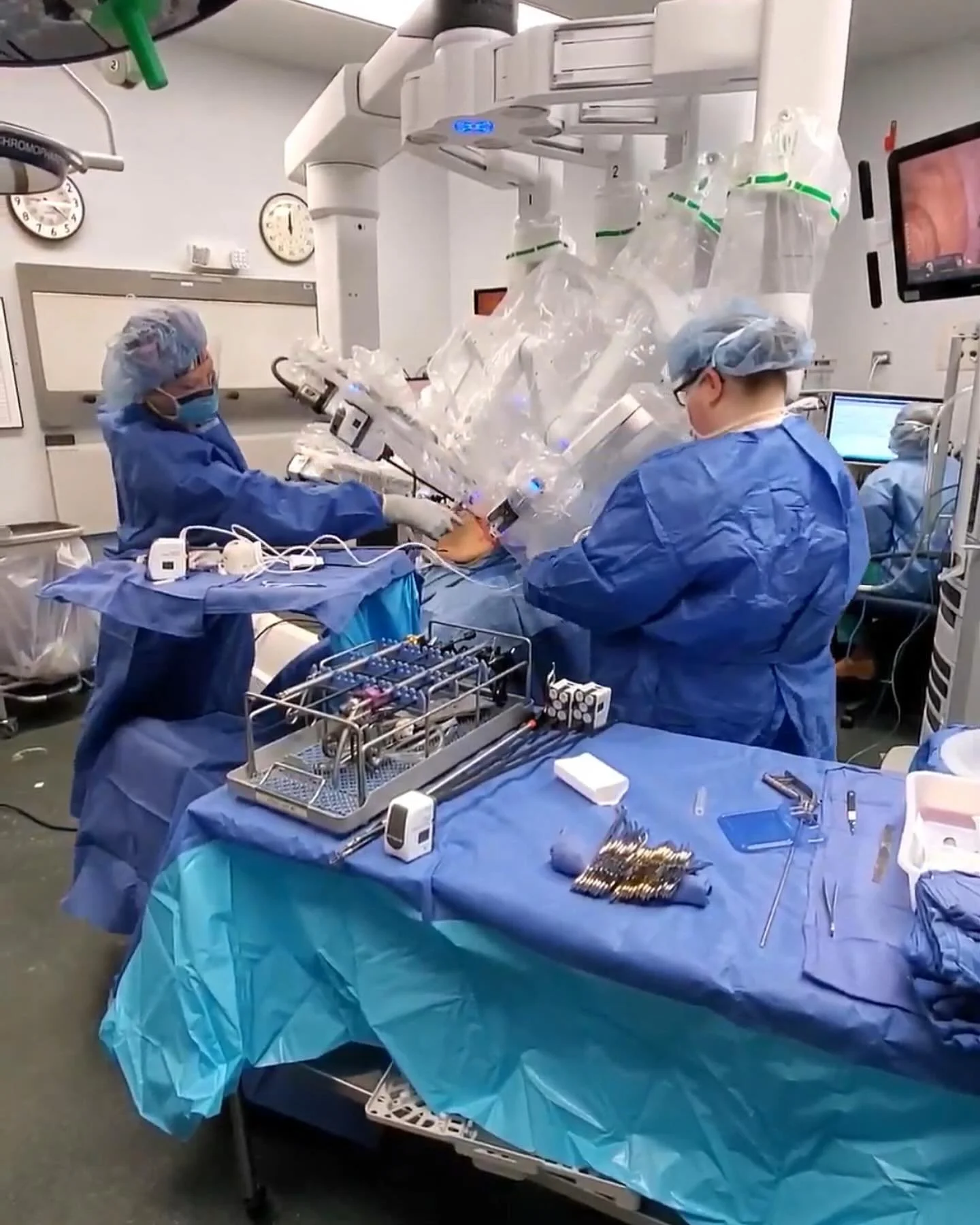 Robotic-assisted surgery represents the future of minimally invasive medicine &mdash; combining the skill of a surgeon with the accuracy of advanced technology.

✅ Smaller incisions
✅ Less pain and faster recovery
✅ Greater precision and control
✅ Re