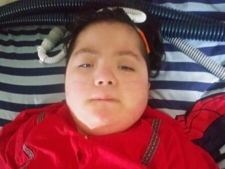 Child lying in a hospital bed with medical tubes and equipment attached