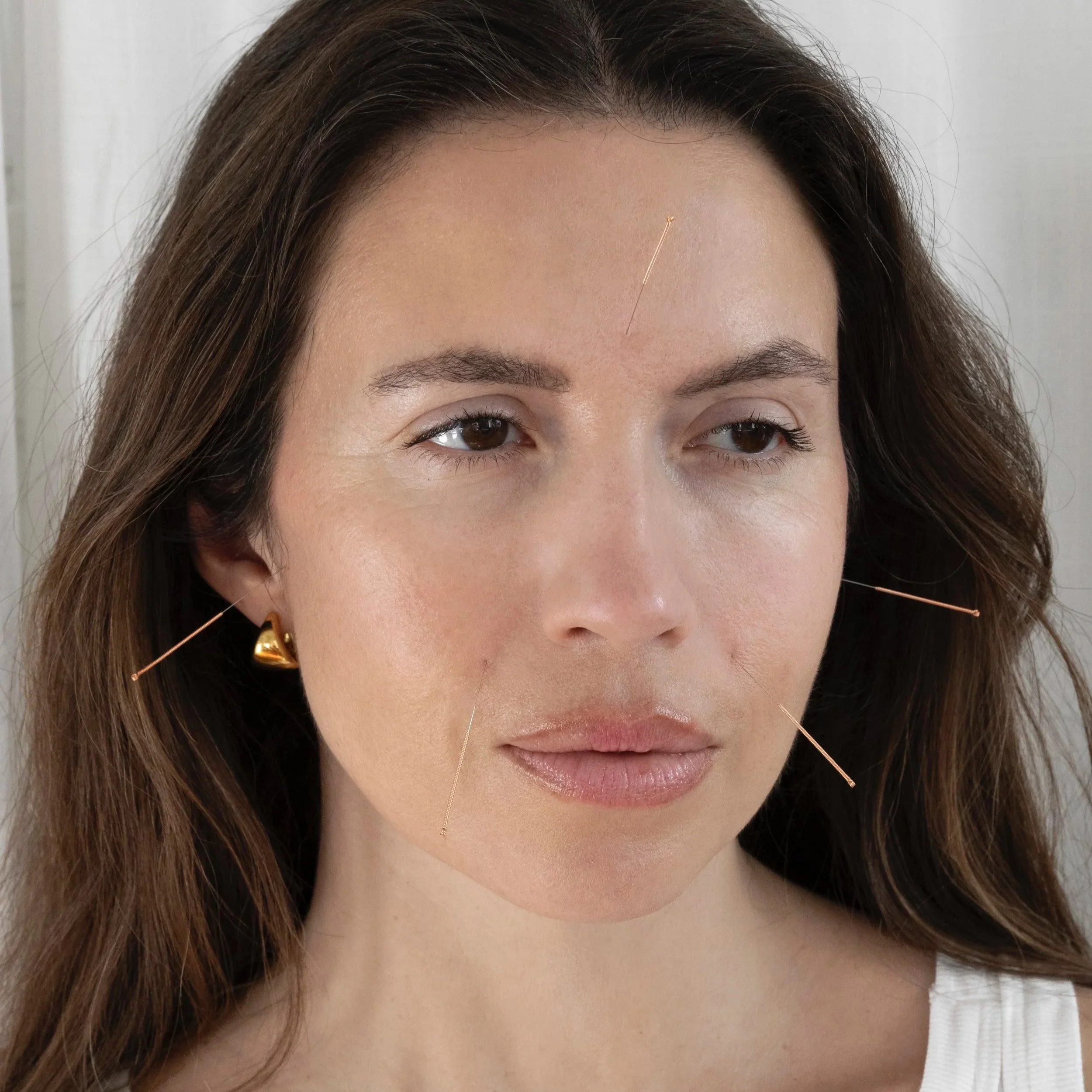Close-up of a woman with acupuncture needles in her face and ears.