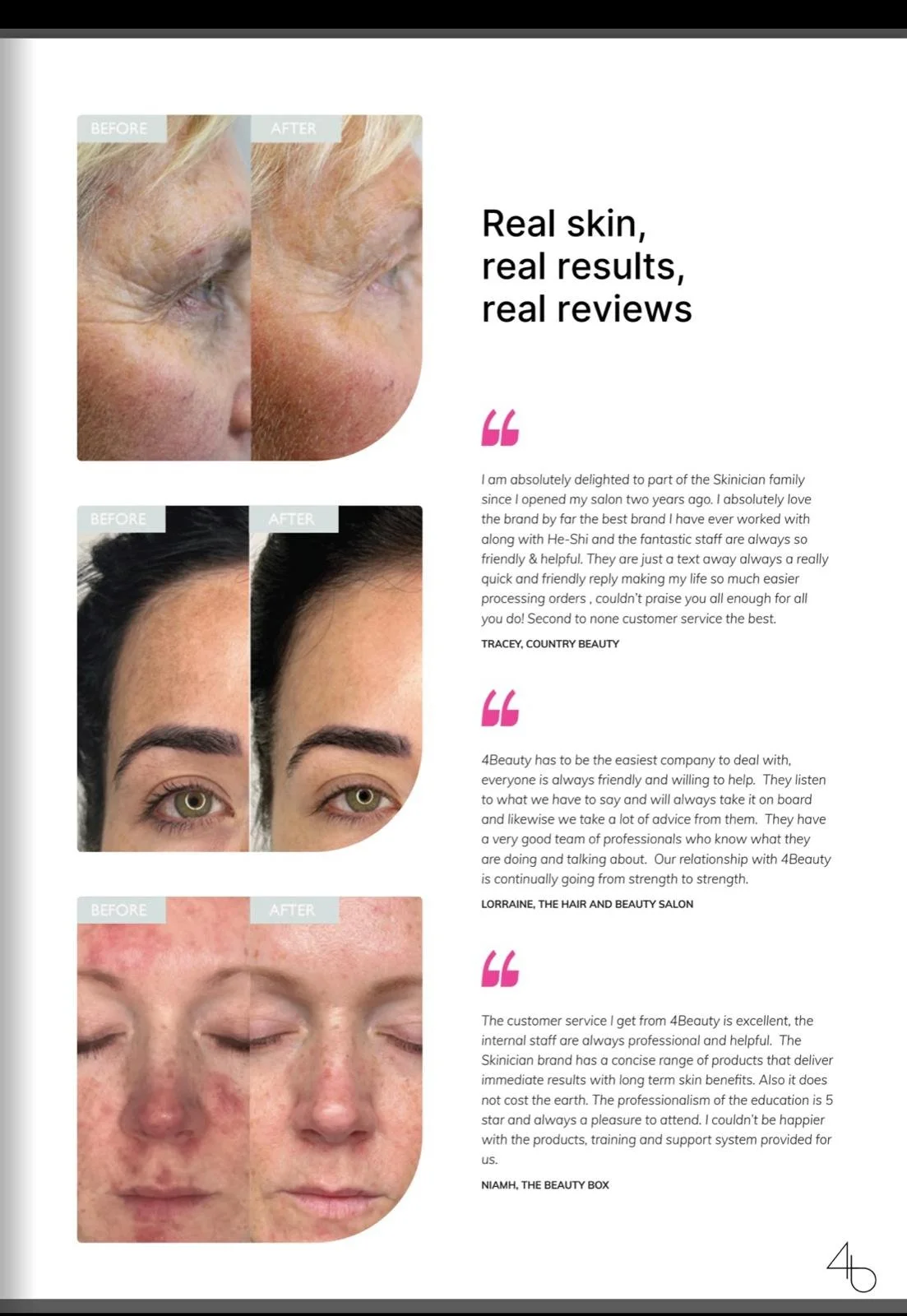 Three sets of before and after images of skin treatments showing improved skin condition on the face, including near the eyes and nose, next to customer reviews and quotes.