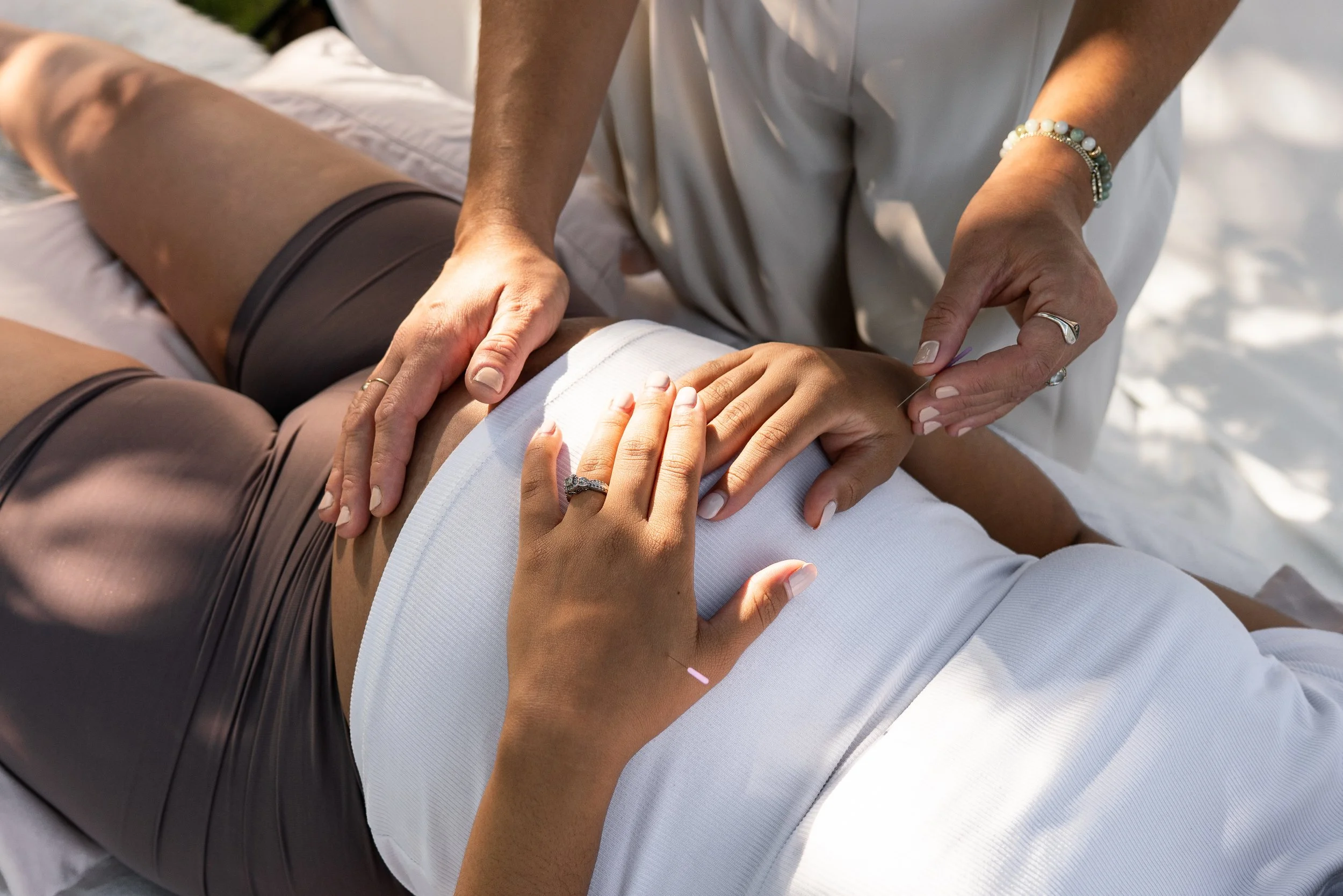 Person receiving acupuncture treatment on their abdomen outdoors, with another person administering the therapy.
