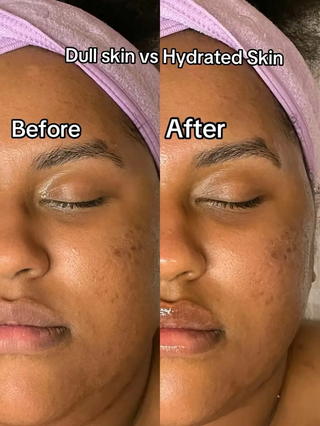 Healthy, glowing skin starts with the right treatment and the right home care. ✨

During this consultation, we discussed my Healthy Aging Facial, an antioxidant-rich treatment designed for my Level 2 clients who are ready to focus on brightening, ren