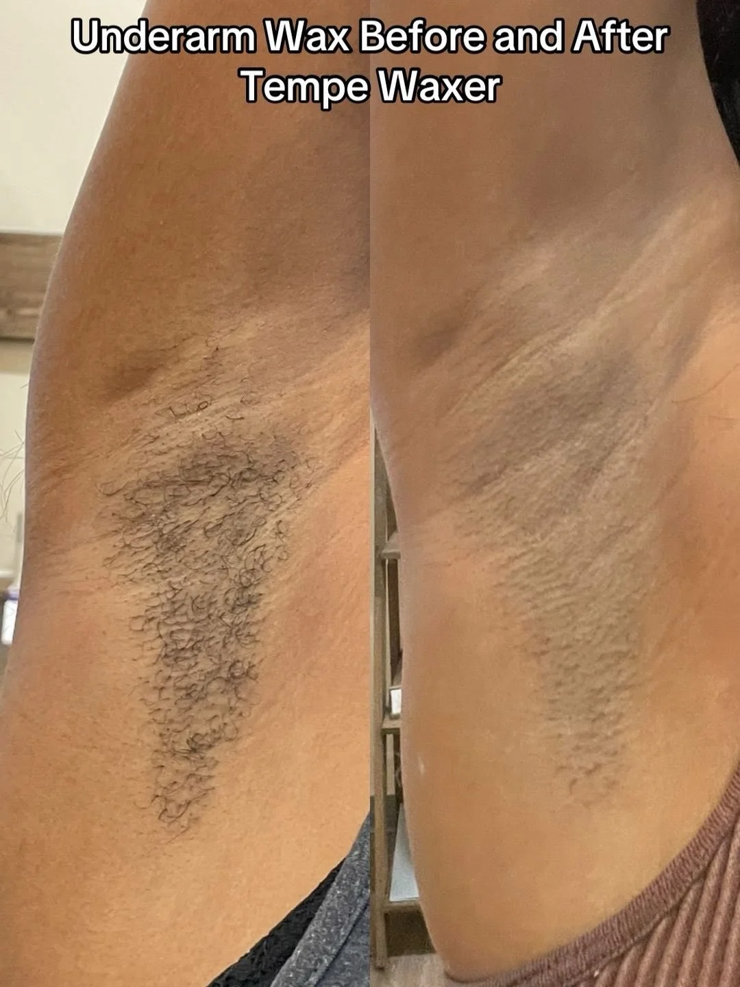 Before ➡️ After ✨
An underarm wax does more than just remove hair. It also removes dead skin buildup, which helps brighten the area and leaves your skin feeling smoother and cleaner.
Shaving can cause dark shadows, irritation, and ingrown hairs. Waxi