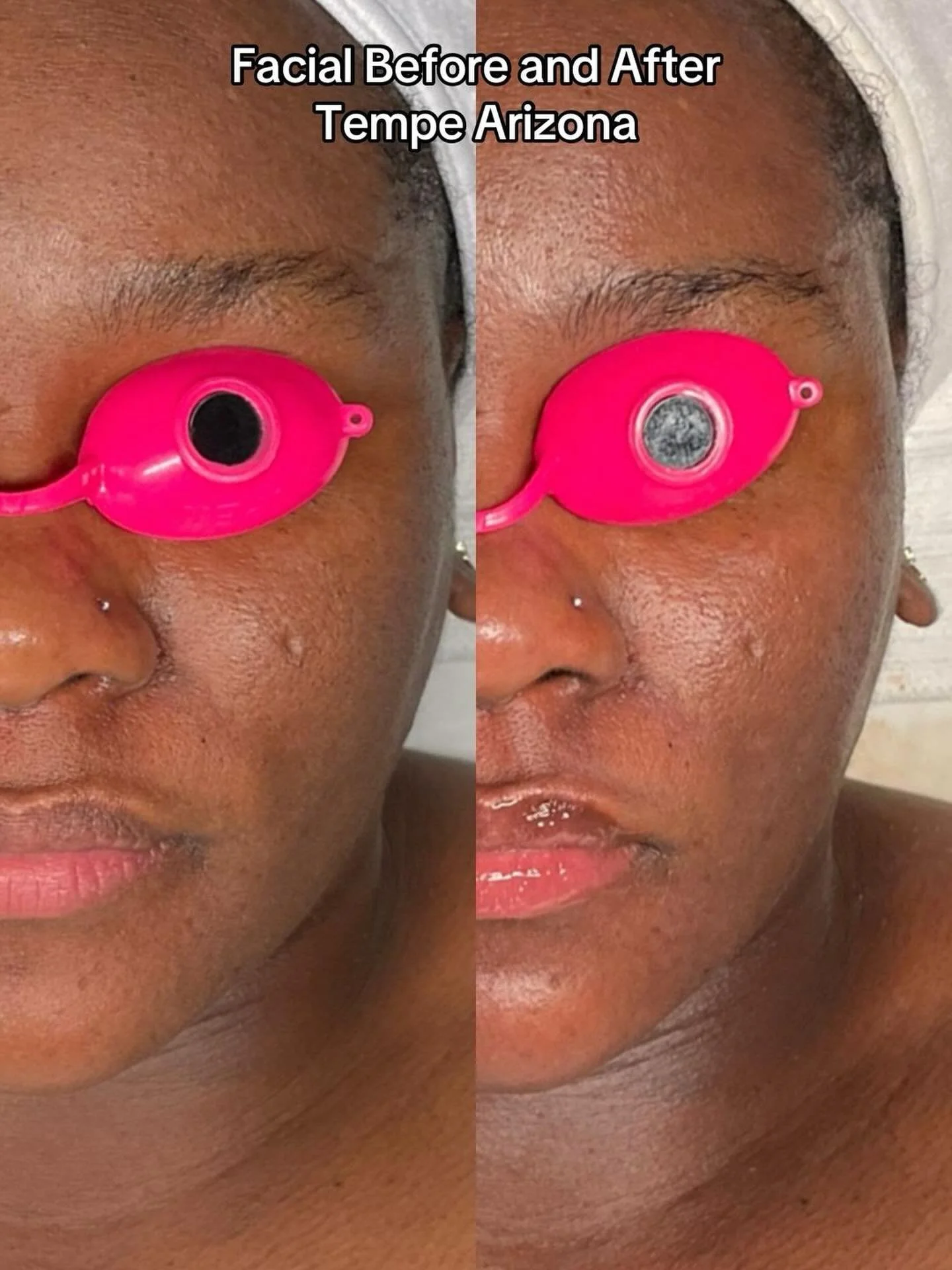 ✨ First Facial Glow ✨

There&rsquo;s nothing better than a first-time client transformation 🤍 We focused on a brightening facial using professional products from Skin Script Skincare to gently exfoliate, boost hydration, and bring life back into the