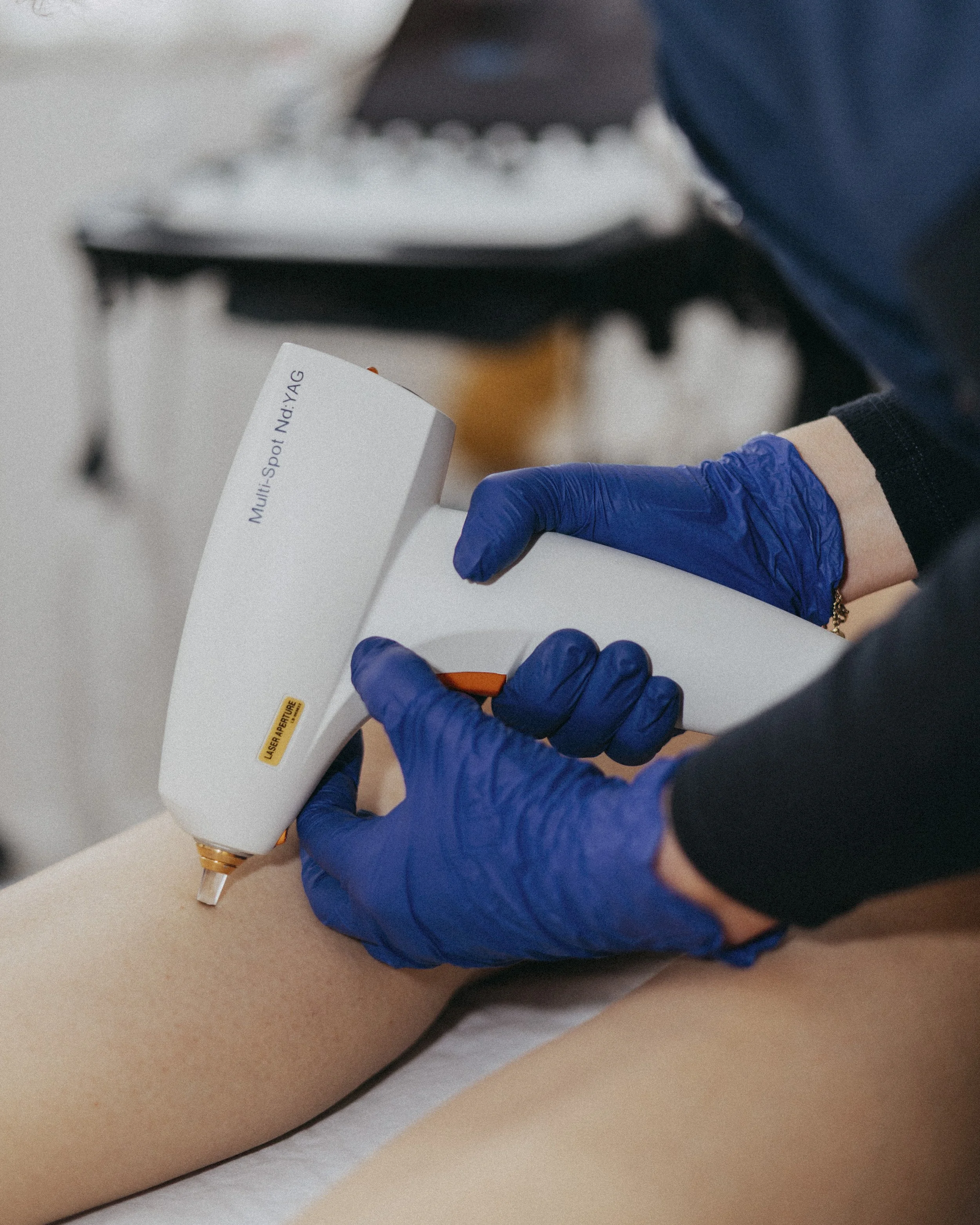 Traitement laser des varicosités à Lyon — Dr Cloé Durdilly, médecin vasculaire