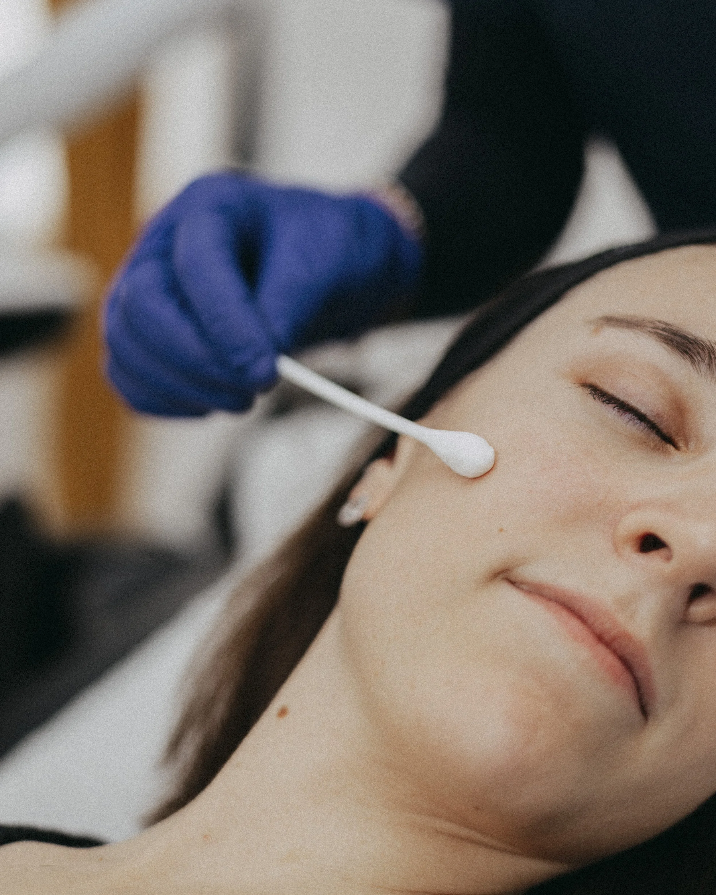 Peeling médical à Lyon, Dr Cloé Durdilly médecin esthétique