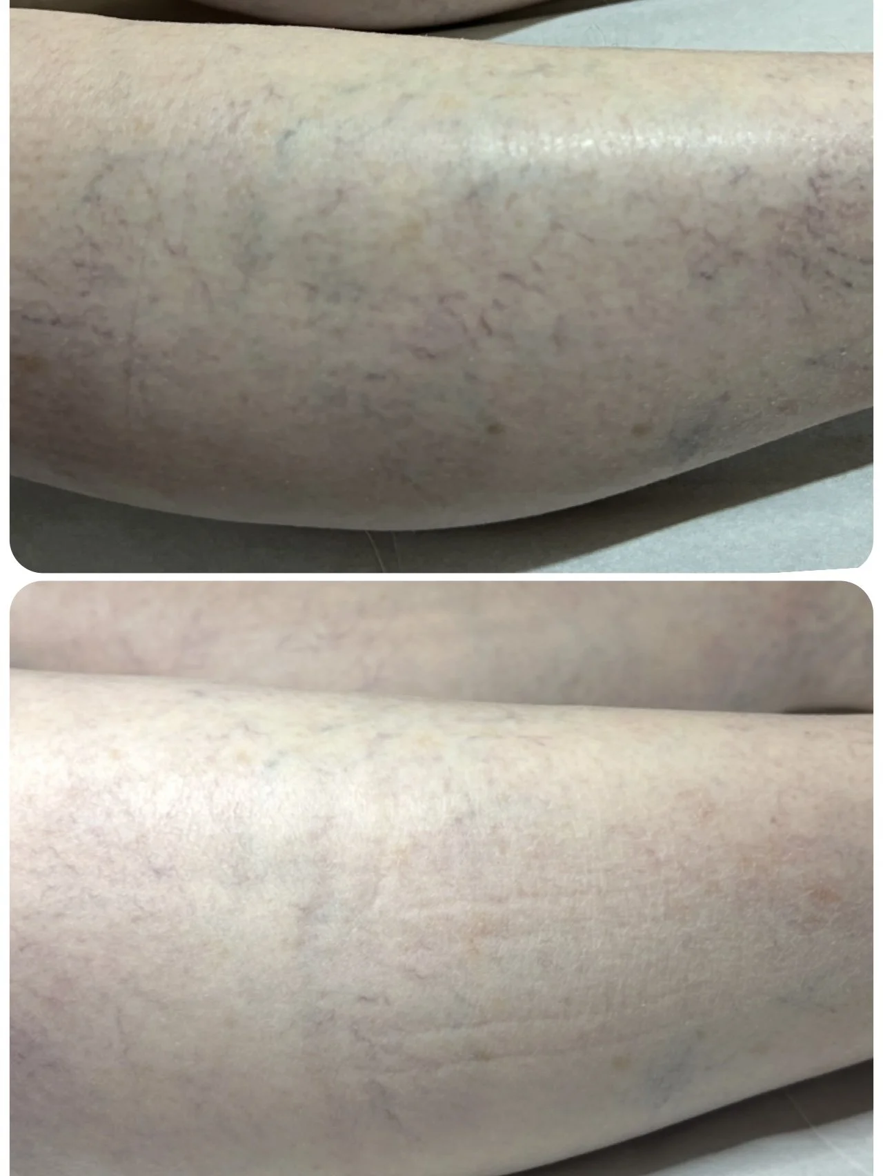 Varicosités à Lyon — Dr Cloé Durdilly, médecin vasculaire