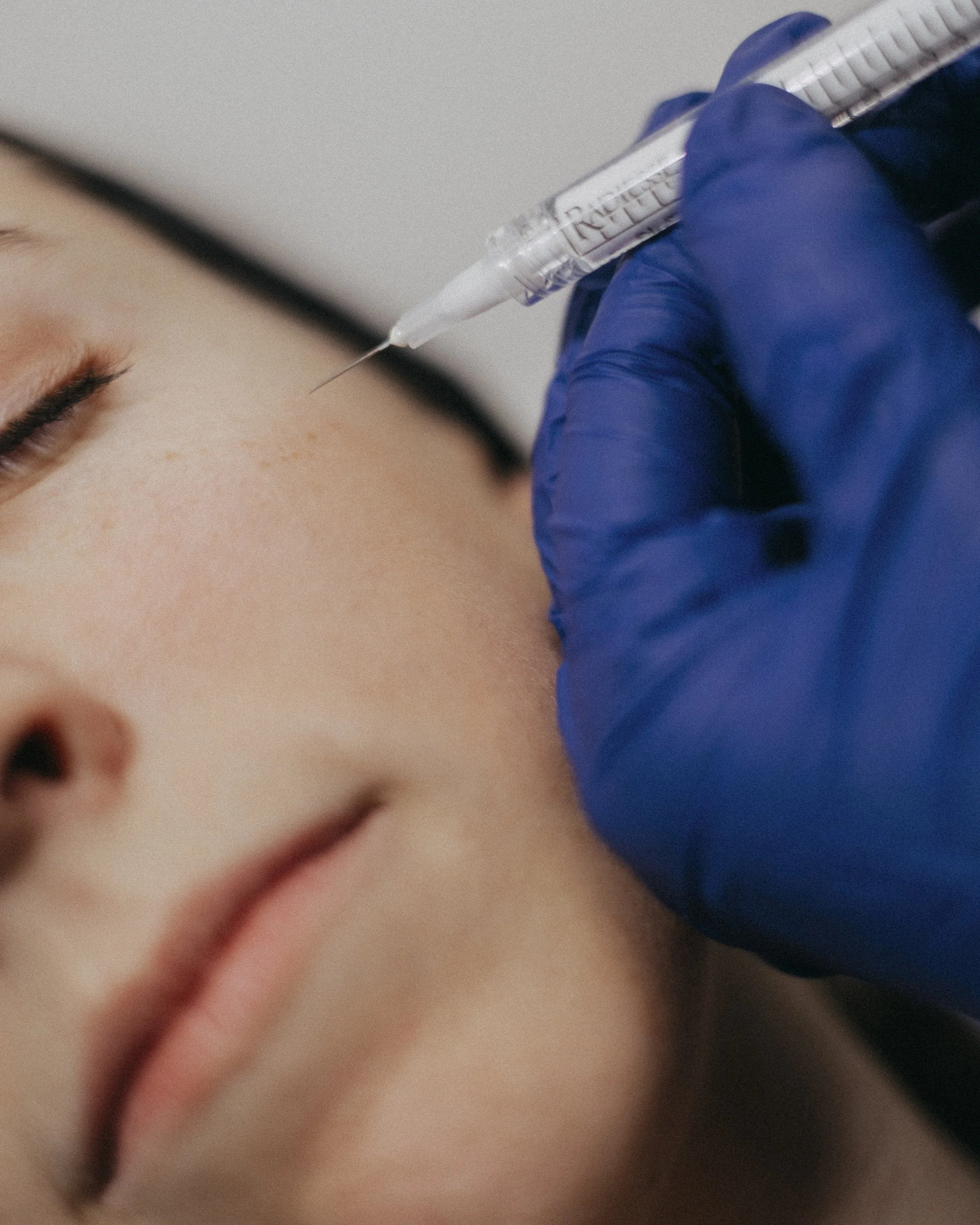 Injection acide hyaluronique Lyon, Dr Cloé Durdilly médecin esthétique