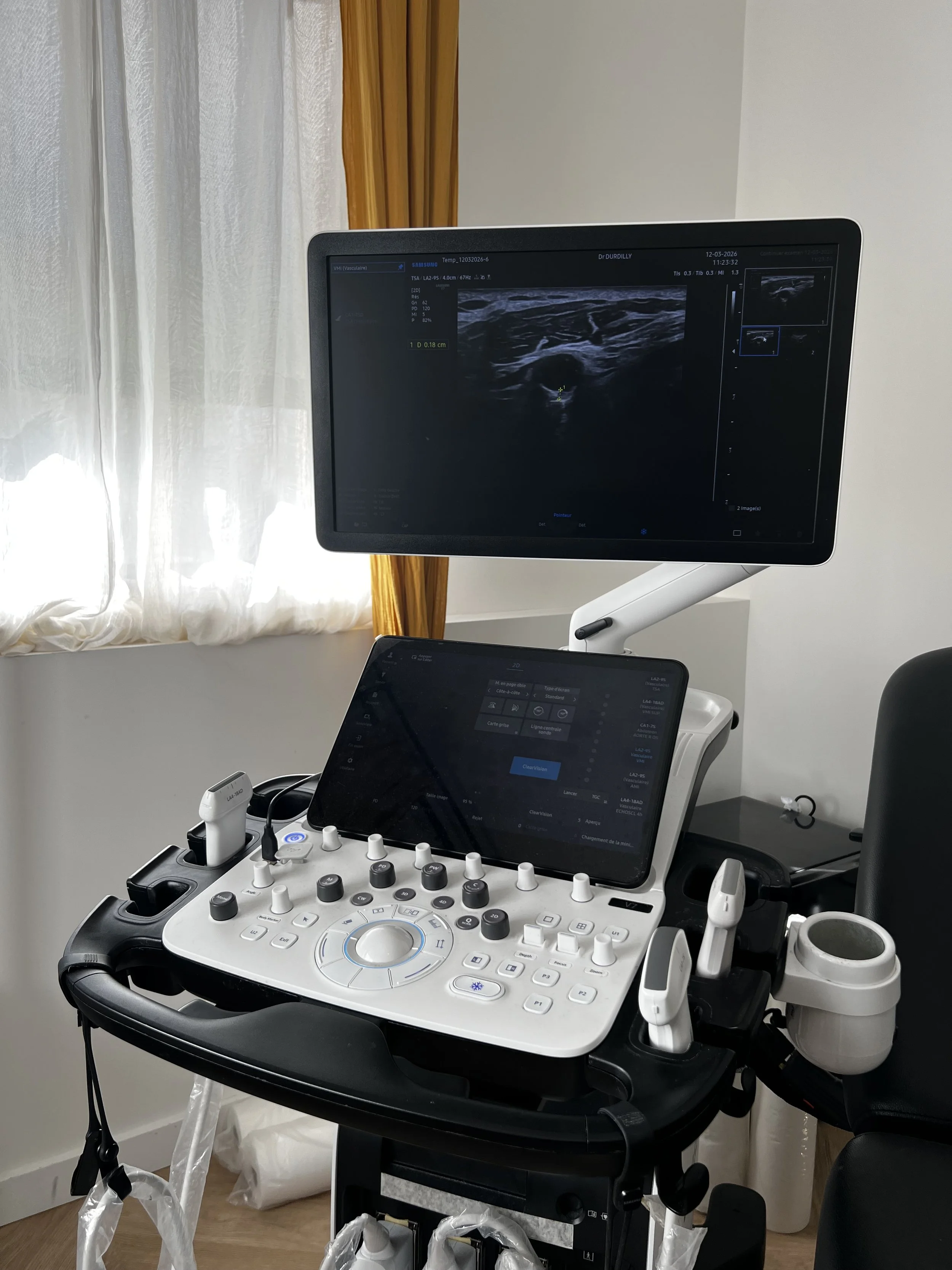 Artériopathie des membres inférieurs à Lyon — Dr Cloé Durdilly, médecin vasculaire