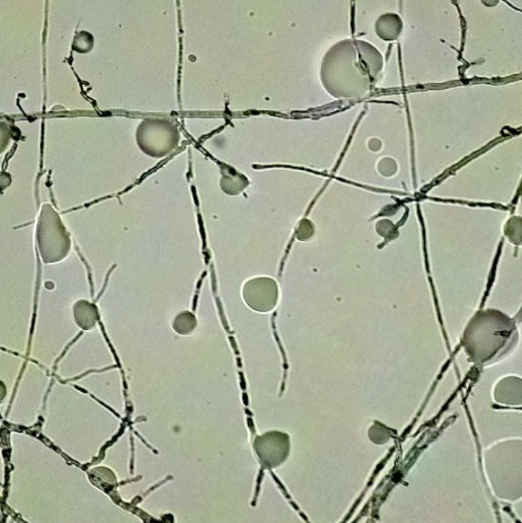 Myceliation Stability at Scale: Regime-Aware Learning