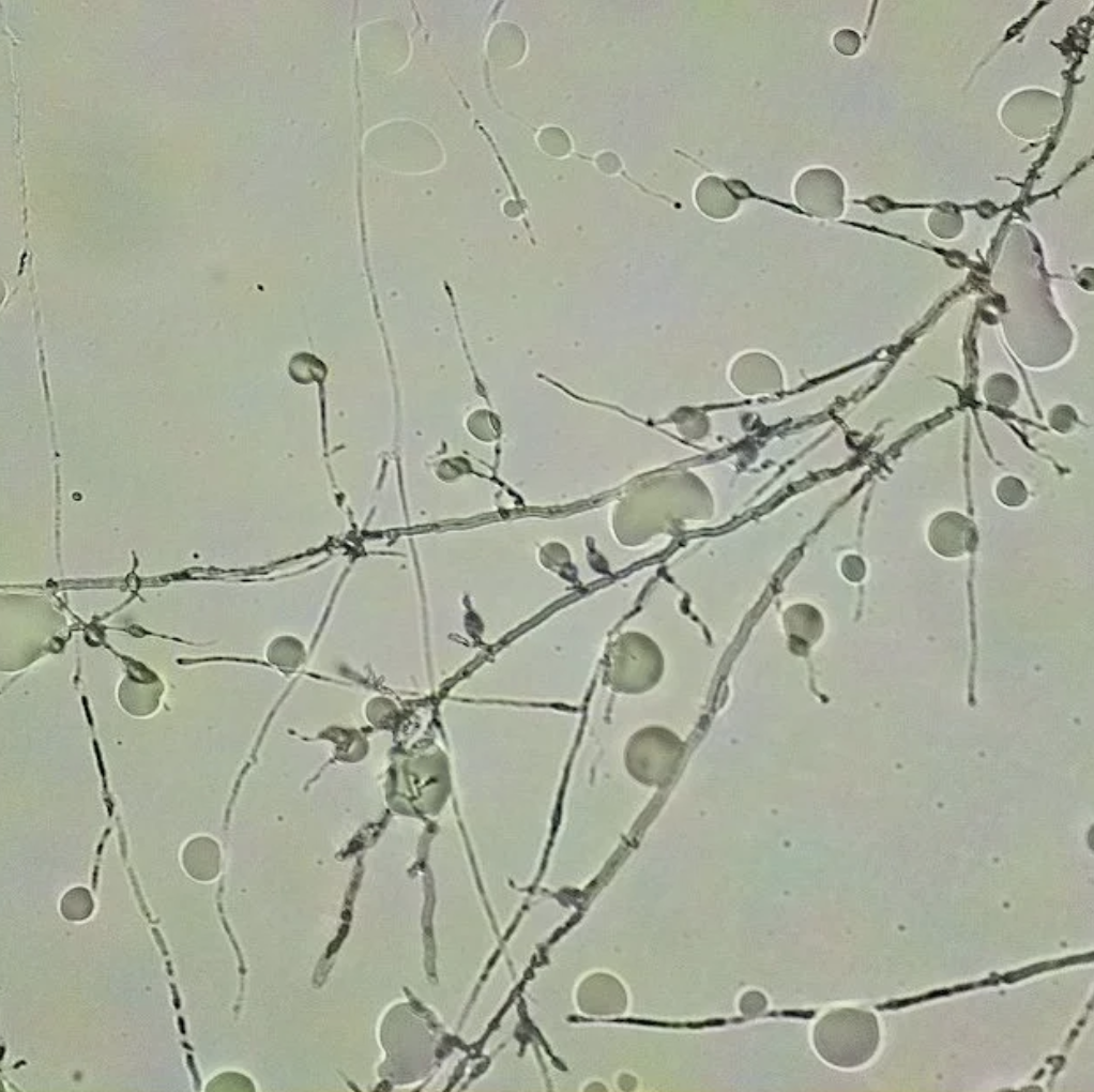 Mycelium as a Logic of Tissues