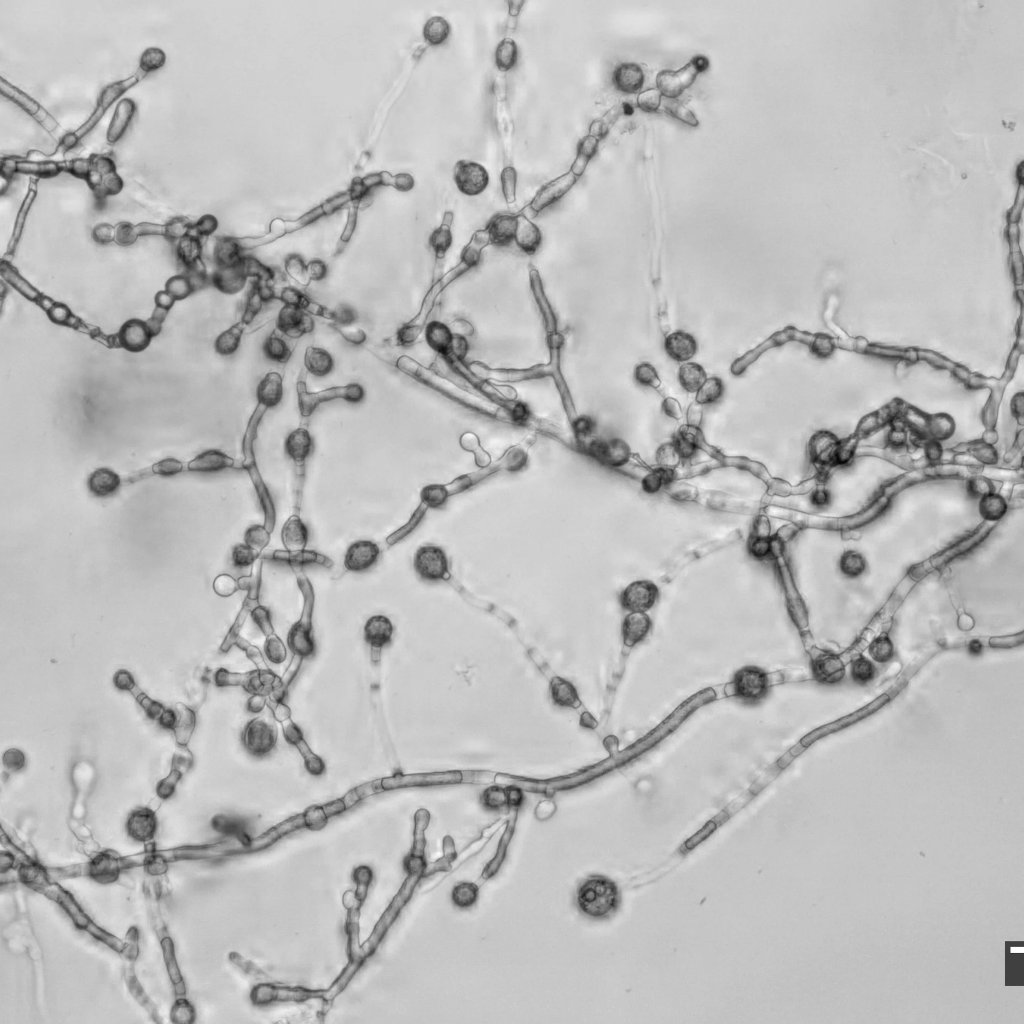 Mycelium as Manifold (And the Peril of Biomass Proxies)