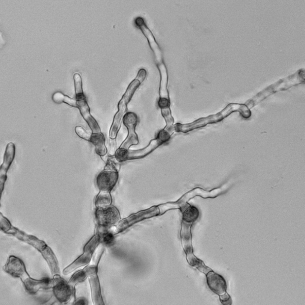 Questioning Assumptions and (Inoculum) Potential