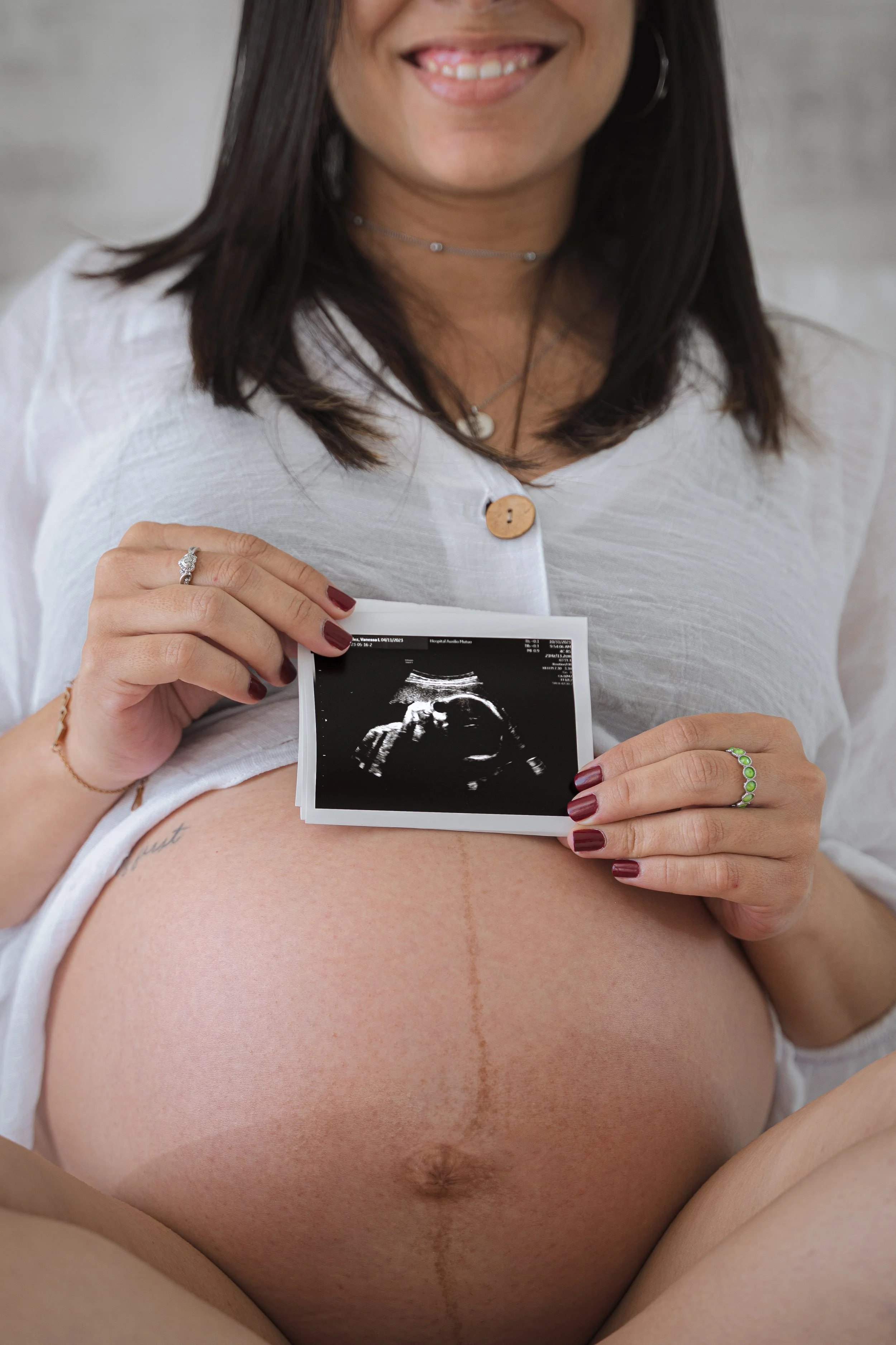 A pregnant woman smiling and holding an ultrasound image of her baby with her right hand while resting her left arm on her bent knee, showing a vertical linea nigra on her belly.