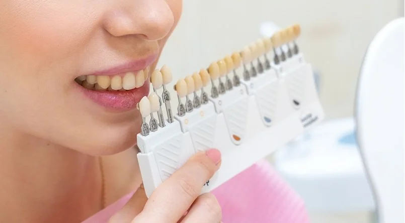 Professional teeth whitening before-and-after showing a dramatic 10-shade improvement achieved in one same-day treatment, featuring a visibly brighter, whiter smile and clean, even results in a modern cosmetic spa setting