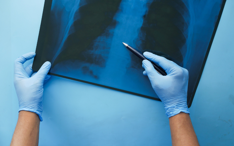 Personal Injury IM Mediator