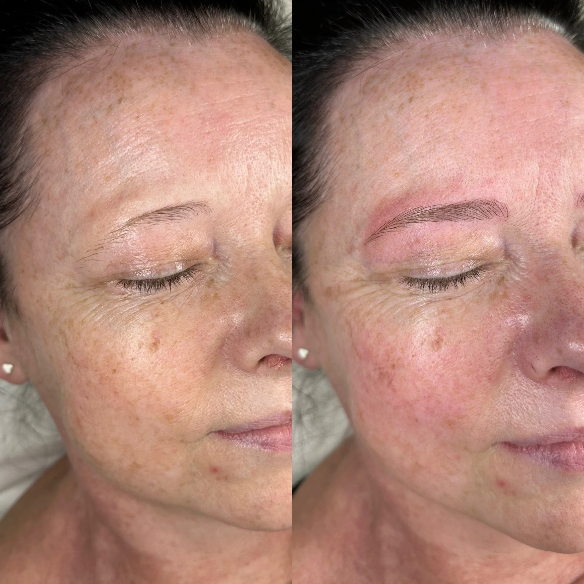 Comparison of a woman's face before and after microblading eyebrow procedure, showing improved eyebrow shape and definition.