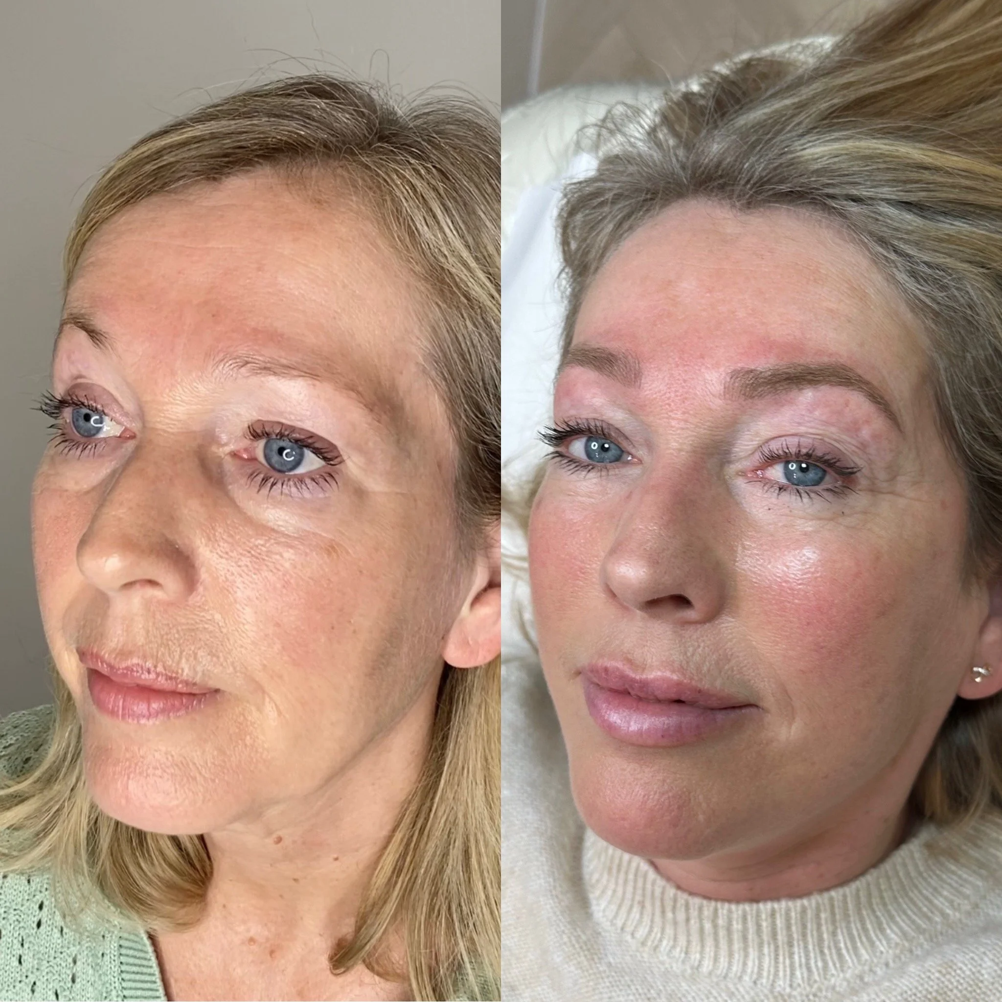 Side-by-side comparison of a woman before and after cosmetic treatment. The left image shows her with a natural appearance, while the right image shows her after treatment with enhanced skin texture, reduced wrinkles, and makeup applied.