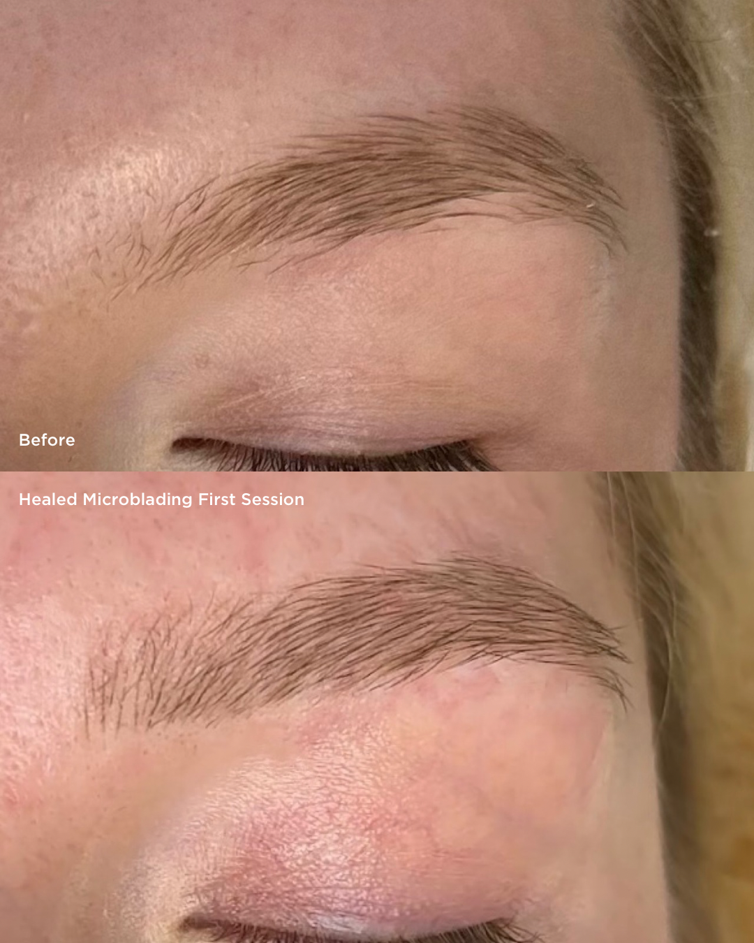 Close-up comparison of a woman's eyebrow and eyelid before and after microblading treatment, showing improved eyebrow fullness and shape.
