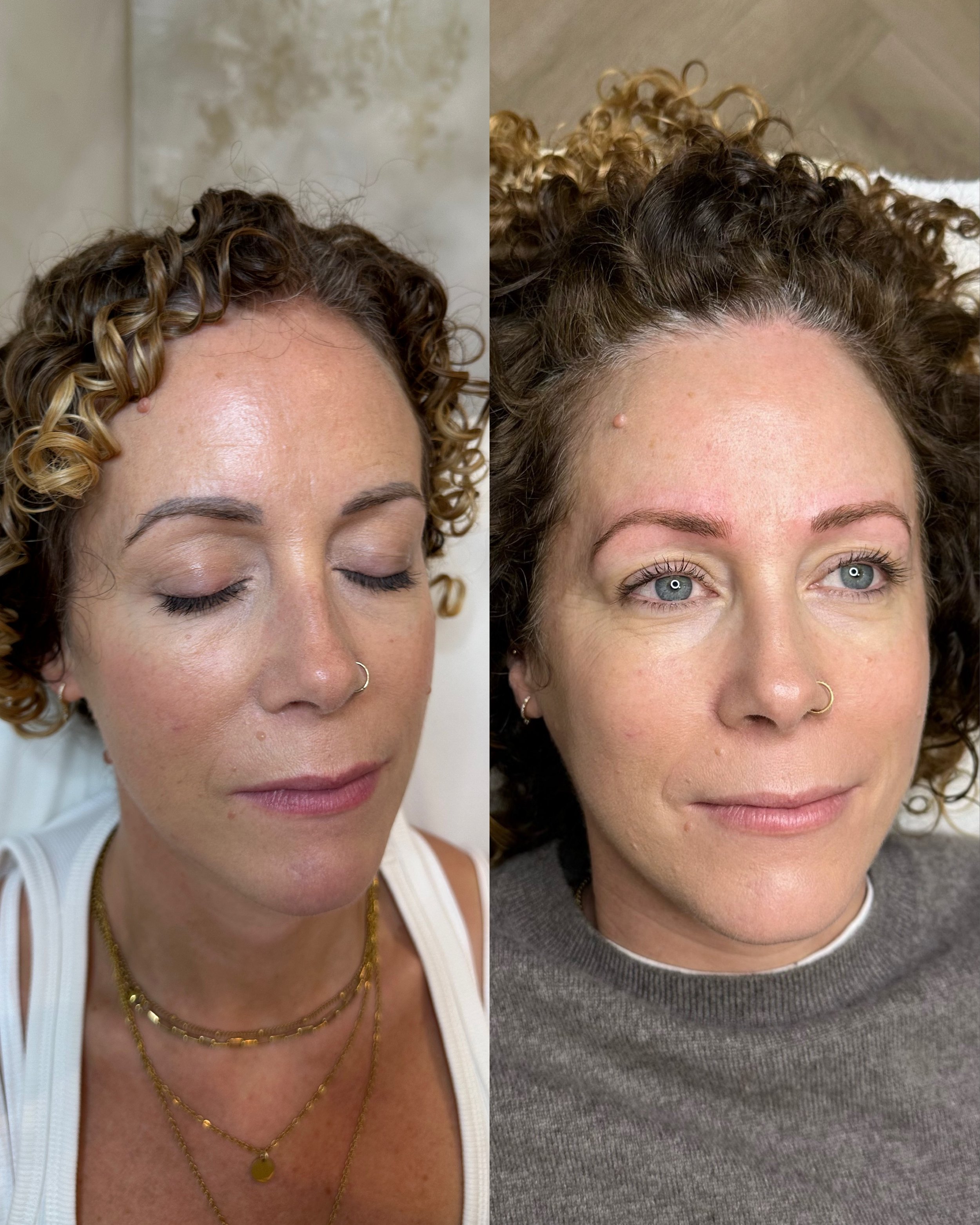 Before and after microblading removal and correction