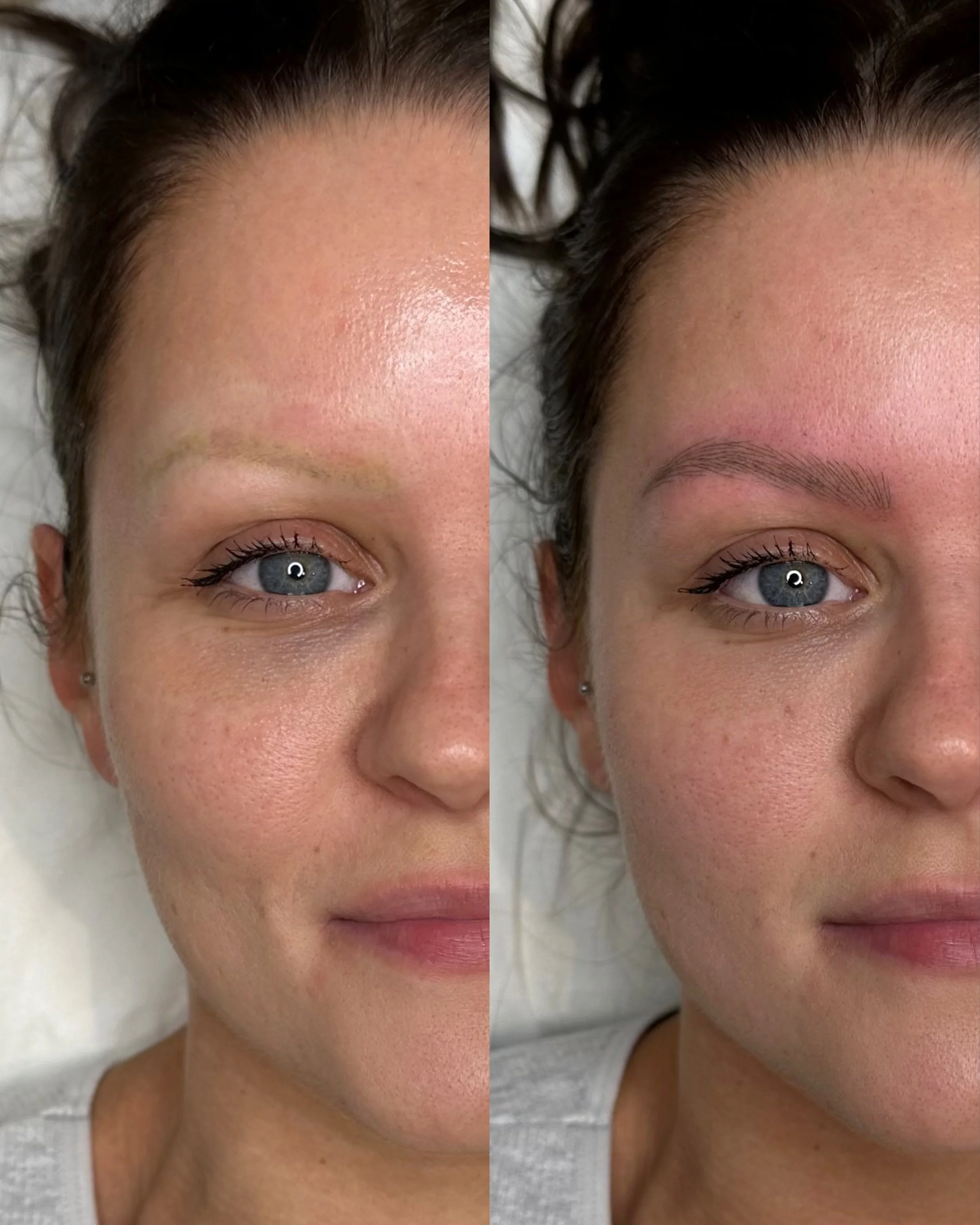 After PMU laser removal and new natural microblading