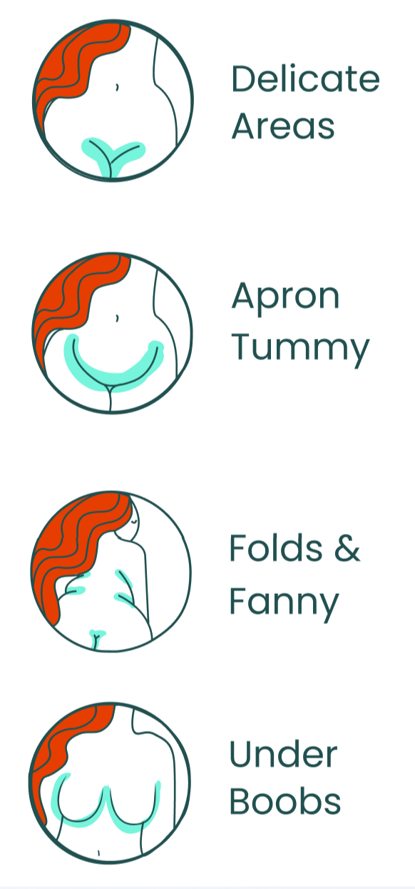 Illustrations showing four different areas of a woman's body with text labels: "Delicate Areas," "Apron Tummy," "Folds & Fanny," and "Under Boobs."