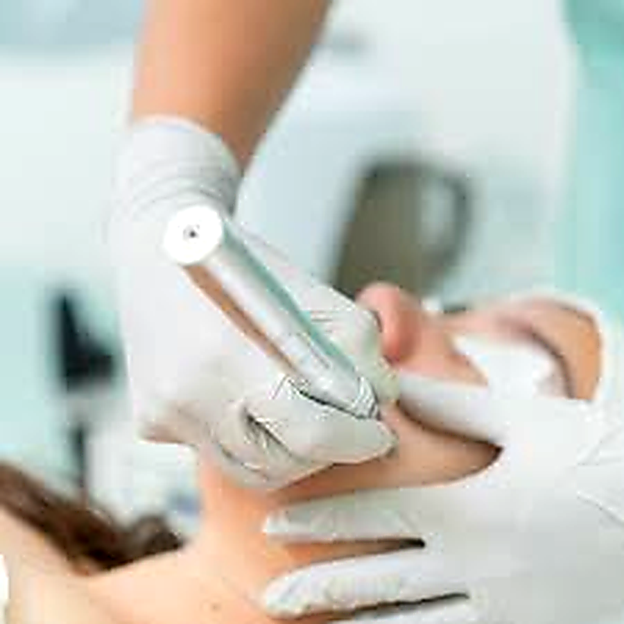 Platelet-Rich Plasma Microneedling