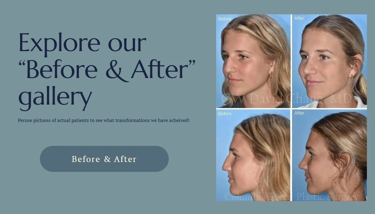 After a long hiatus, our website is back with a fresh new look &mdash; and an all-new Before &amp; After gallery!
Check us out at www.columbia-face.com
.

#FacialPlastics #BeforeAndAfter #CosmeticSurgery #FacialRejuvenation #AestheticSurgery #Rhinopl