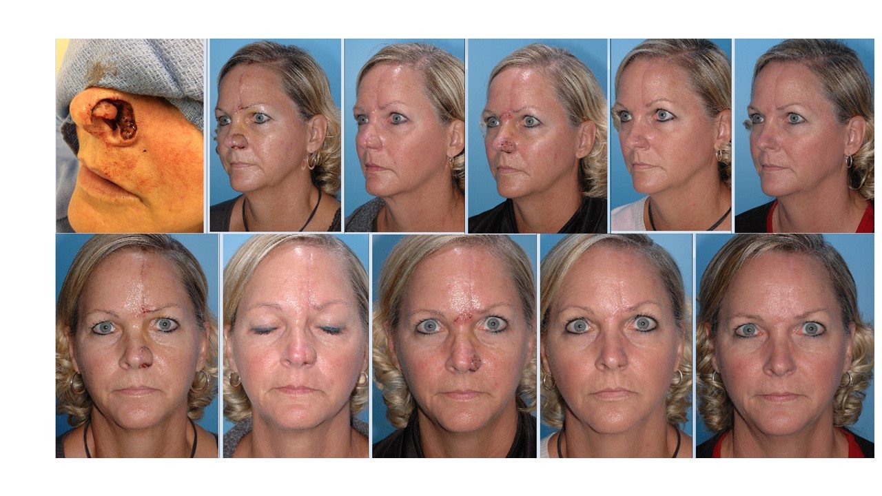 Reconstruction collage.jpg