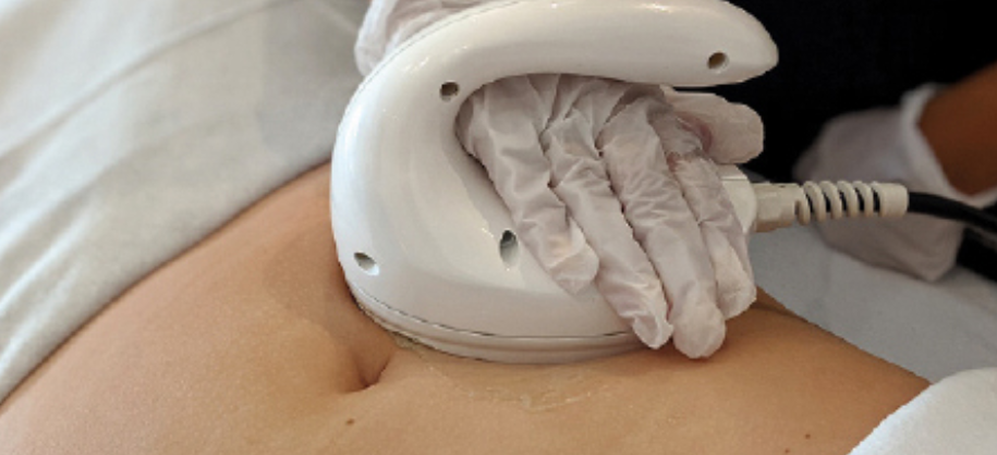 A person undergoing a medical ultrasound procedure on their abdomen.