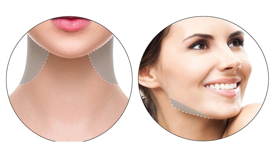Close-up of a woman's neck and jawline before and after skincare or cosmetic treatment, with dotted lines indicating targeted areas.
