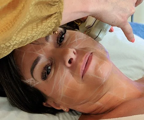 Woman receiving a facial treatment with a device on her face in a skincare clinic