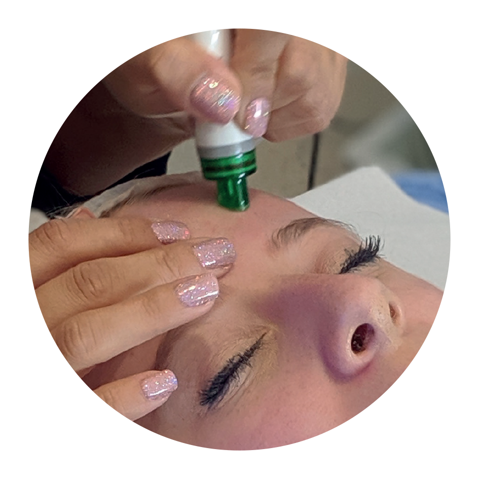 A person lying down with eyes closed receives a cosmetic treatment on their forehead using a green and white device held by a practitioner with sparkly pink nails.
