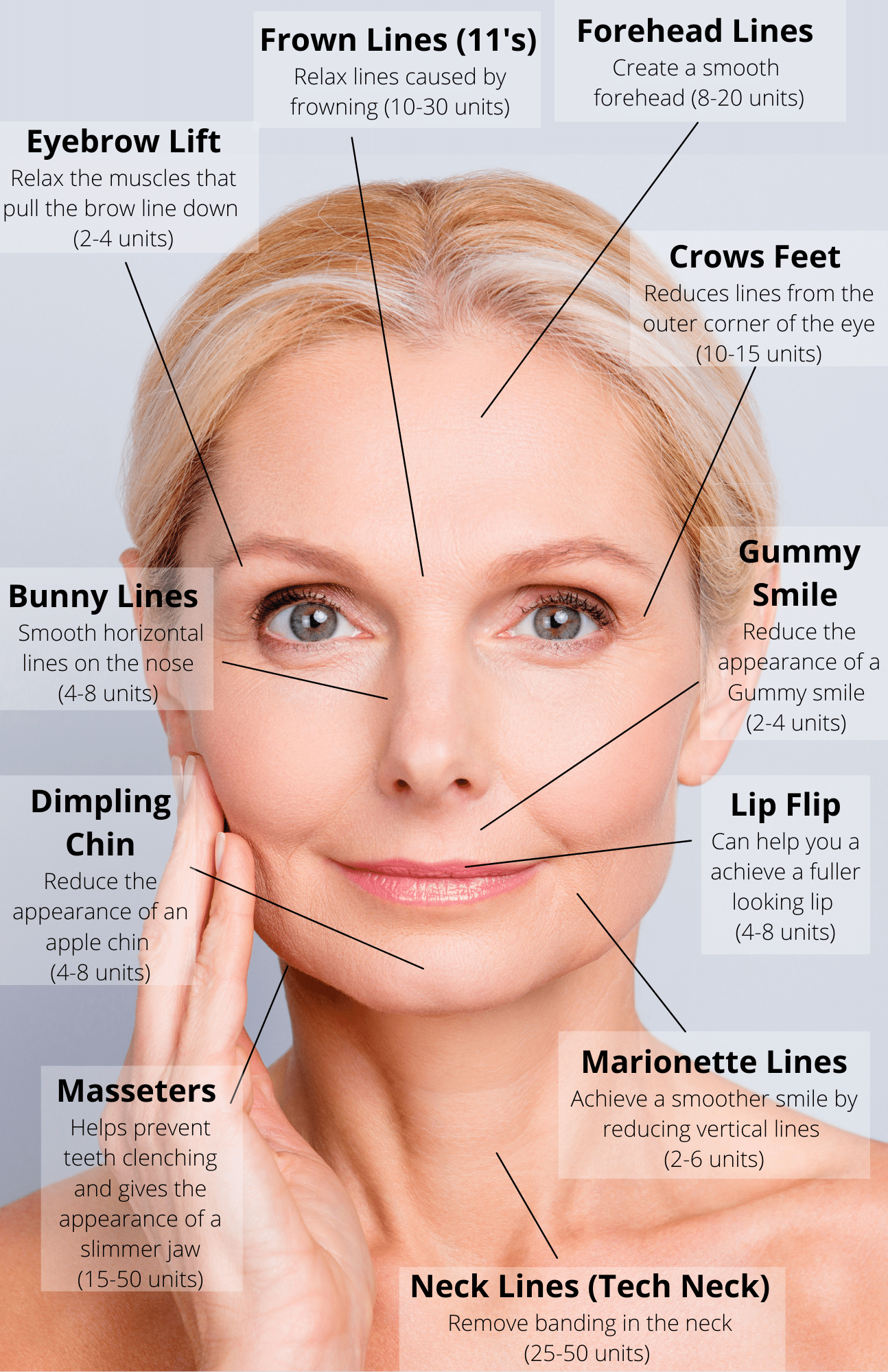 Botox $14 Per Unit