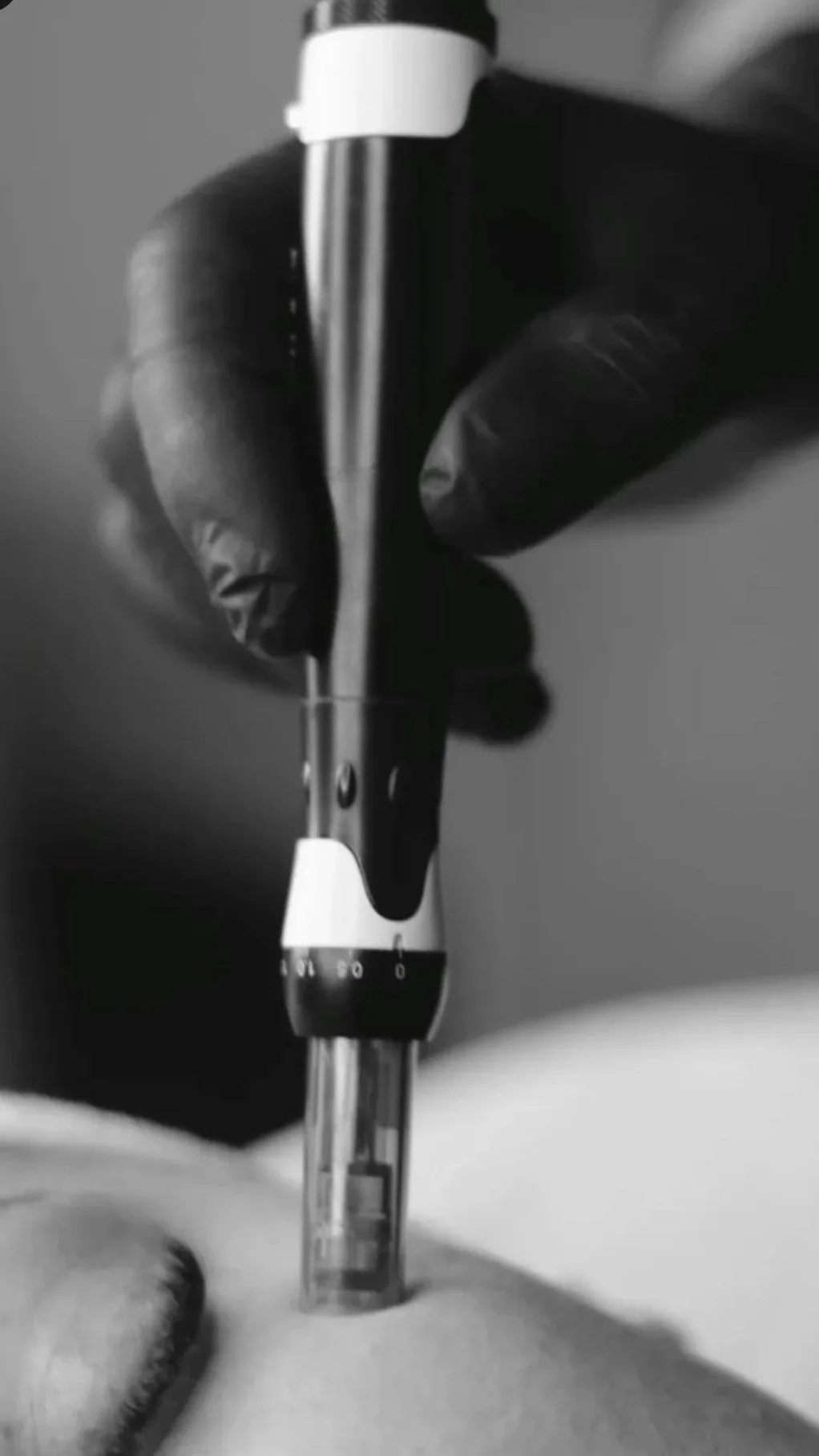 Close-up of a person wearing black gloves using a syringe to give an injection into a patient's arm.