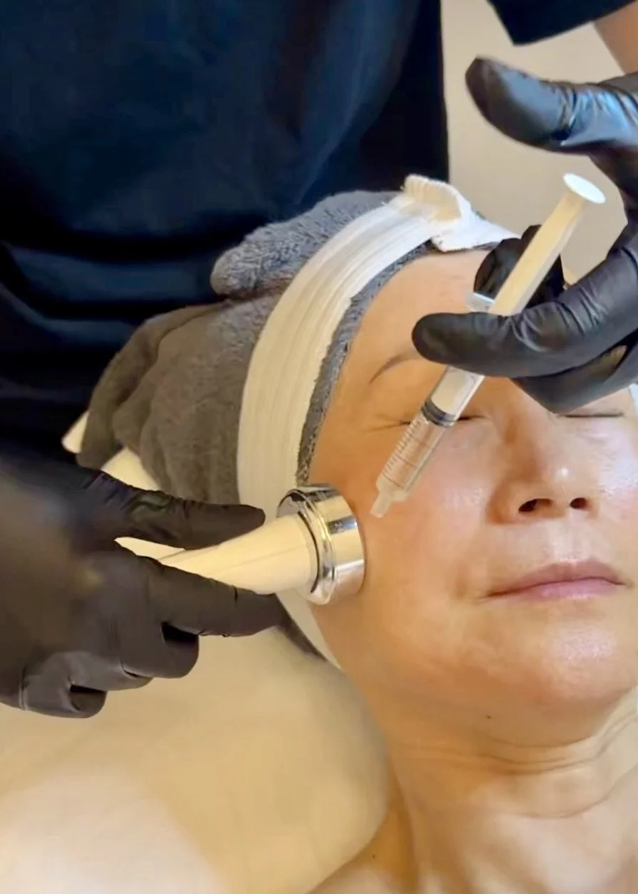 At MoonSun Esthetics - A person receiving a cosmetic injection treatment on their face, with a clinician wearing black gloves and using a syringe and a handheld device while lying on a treatment bed.