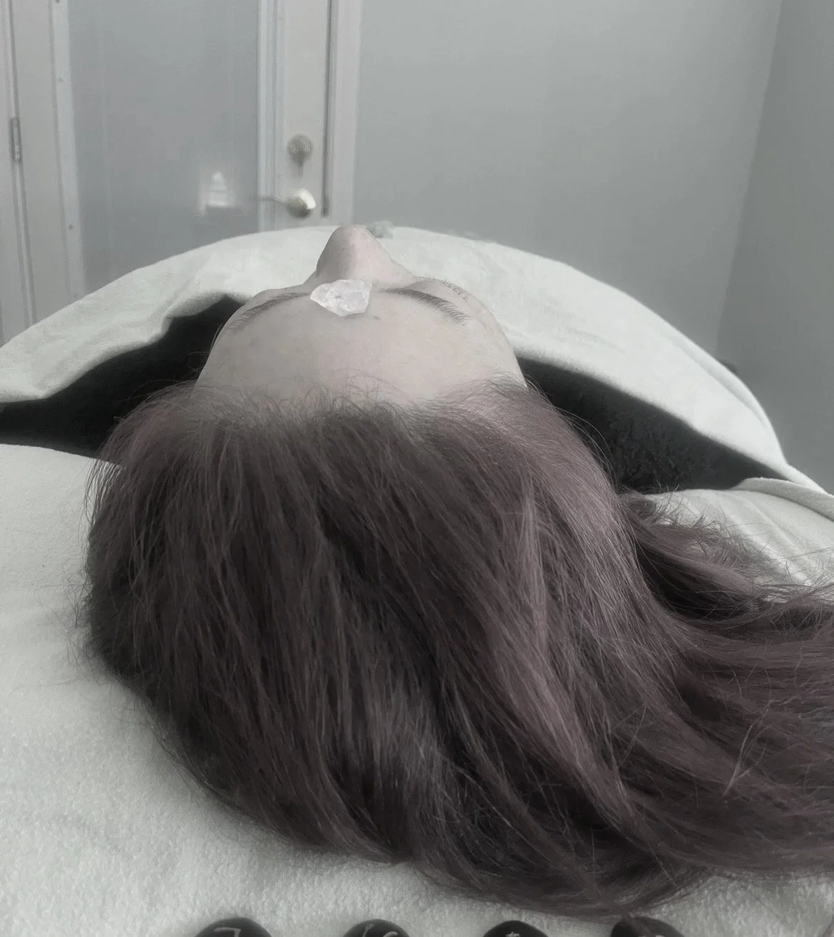 Person lying down on a medical bed with a gauze on their nose and red hair, in a clinical setting.