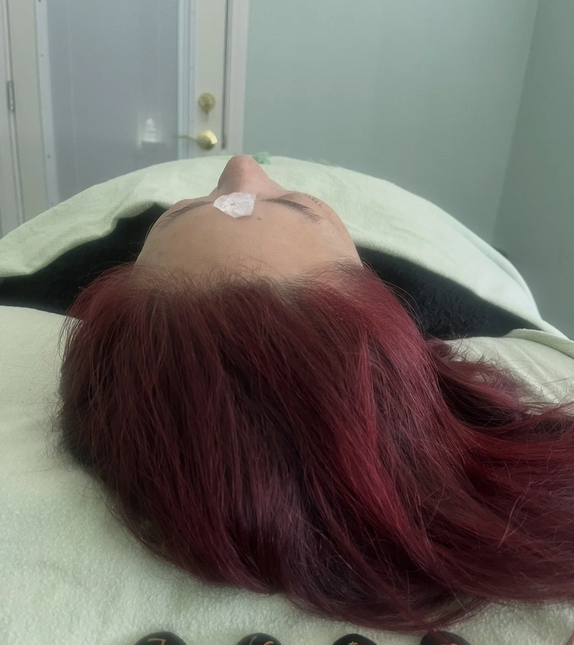 Person lying down on a medical bed with a gauze on their nose and red hair, in a clinical setting.