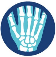 Illustration of a hand orthopaedic surgeon sydney