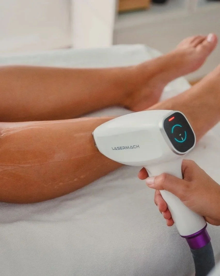 Traitement d’épilation au laser diode LASERMACH appliqué sur la peau, réalisé dans un centre de soins professionnels.