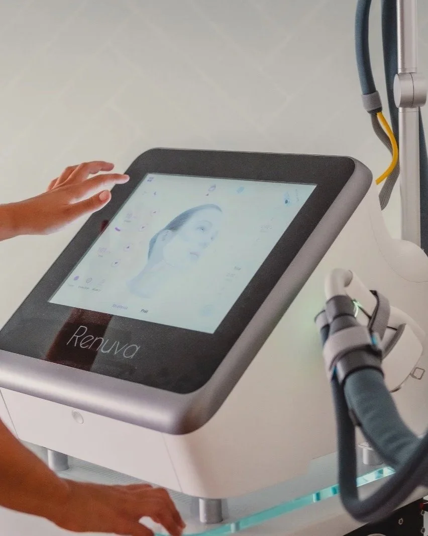 Appareil Renuva de laser fractionné Erbium 1550 nm avec écran tactile, utilisé pour les soins de rajeunissement cutané et l’amélioration de la texture de la peau.